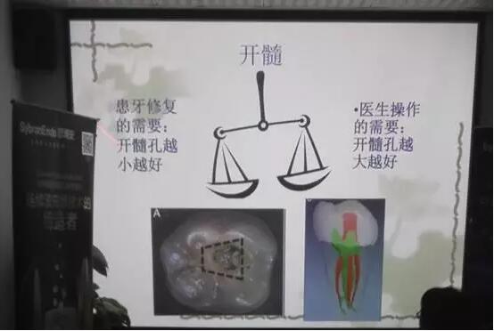 正夫牙体牙髓培训